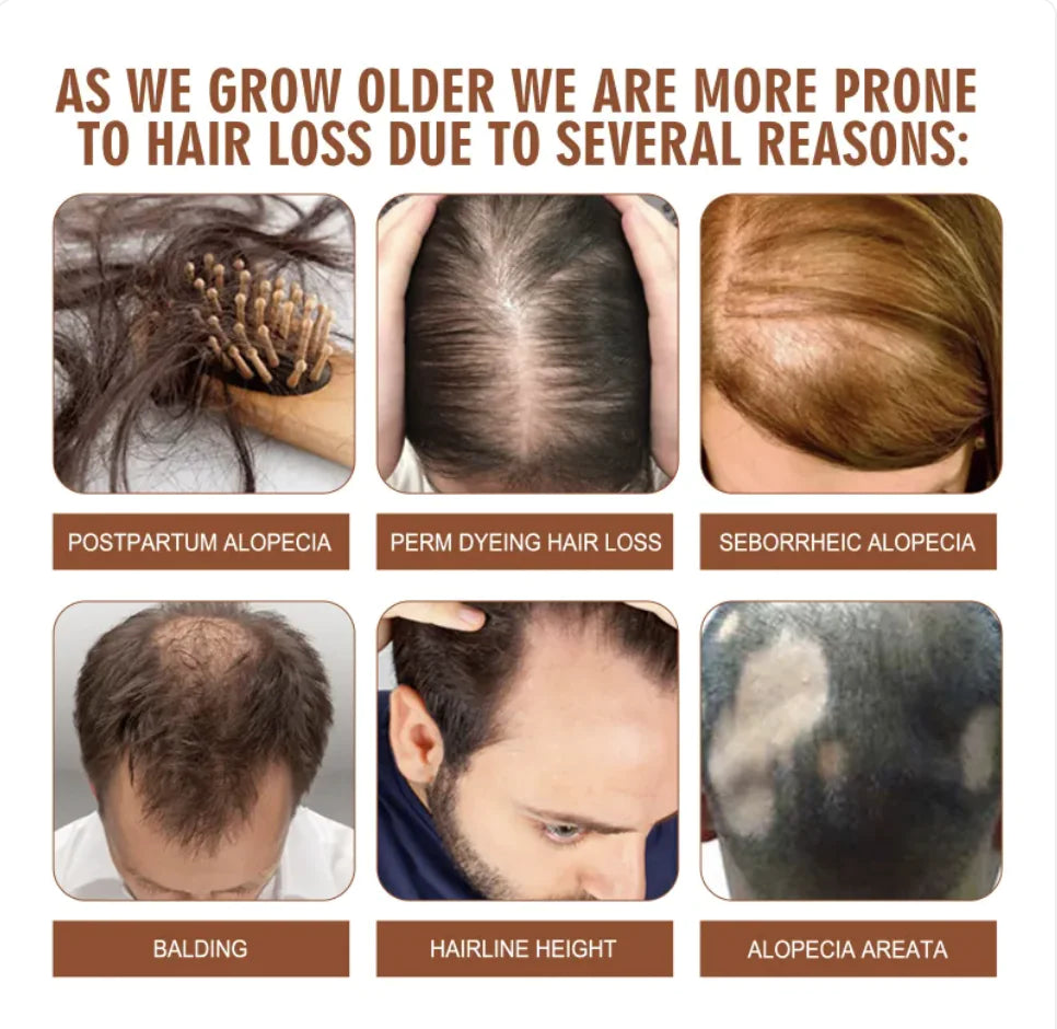 Reasons why aging are more prone to hair loss