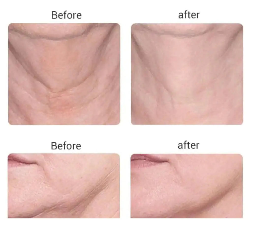 Before and After using Beauty Microcurrent Facial Toning Massager on the neck and jawline