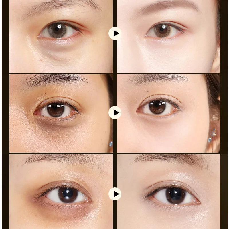 Before and after results 