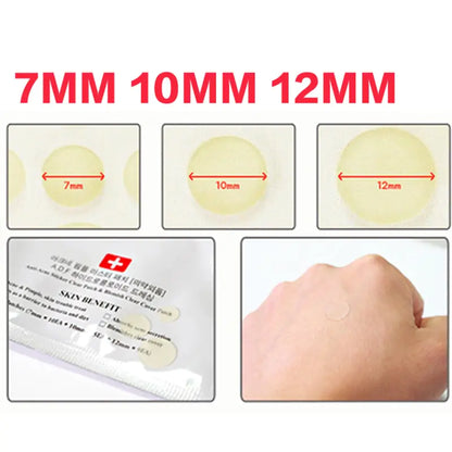 Acne Pimple Invisible Patch Sizes 7mm, 10mm, 12mm