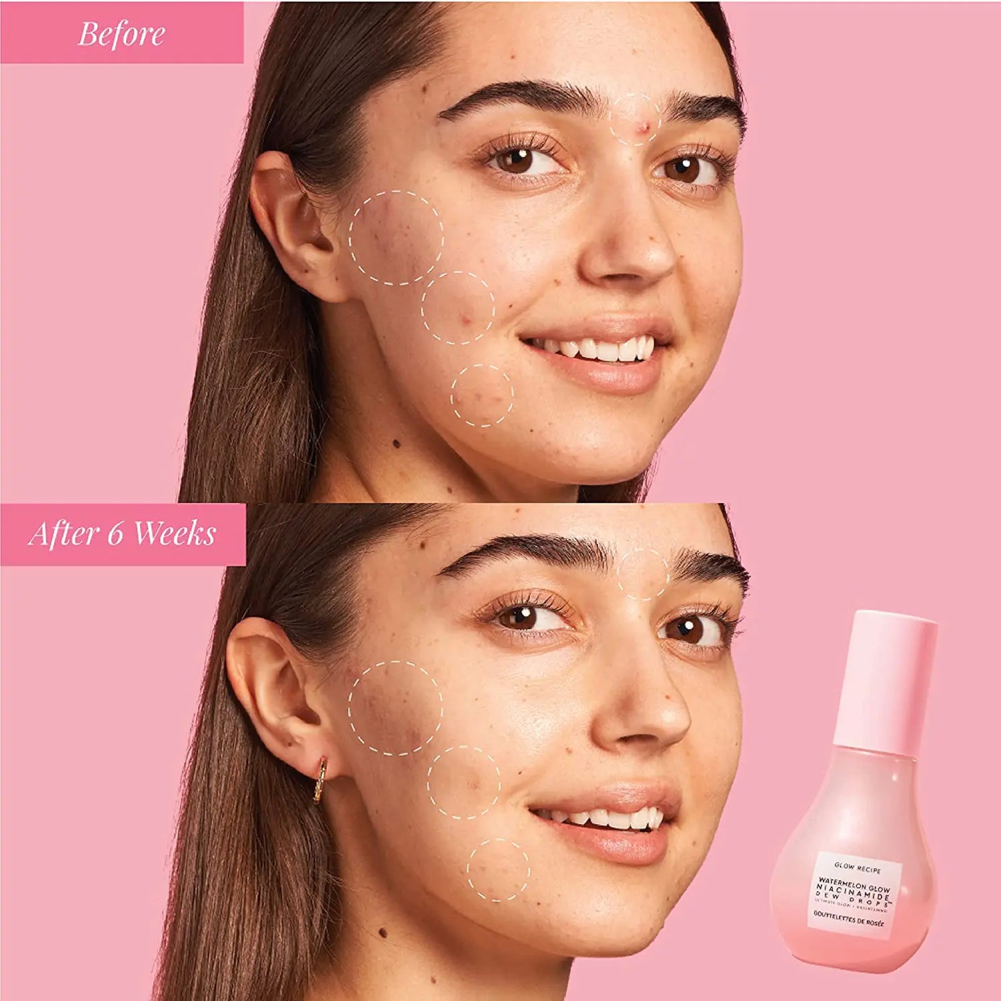 Before and After 6 Weeks Using Glow Recipe Watermelon Glow Niacinamide Dew Drop