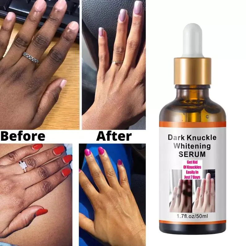 Before and After Using the Dark Knucke Whiteningf Serum