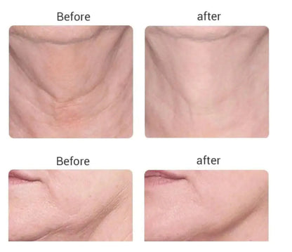 Before and After using Beauty Microcurrent Facial Toning Massager on the neck and jawline