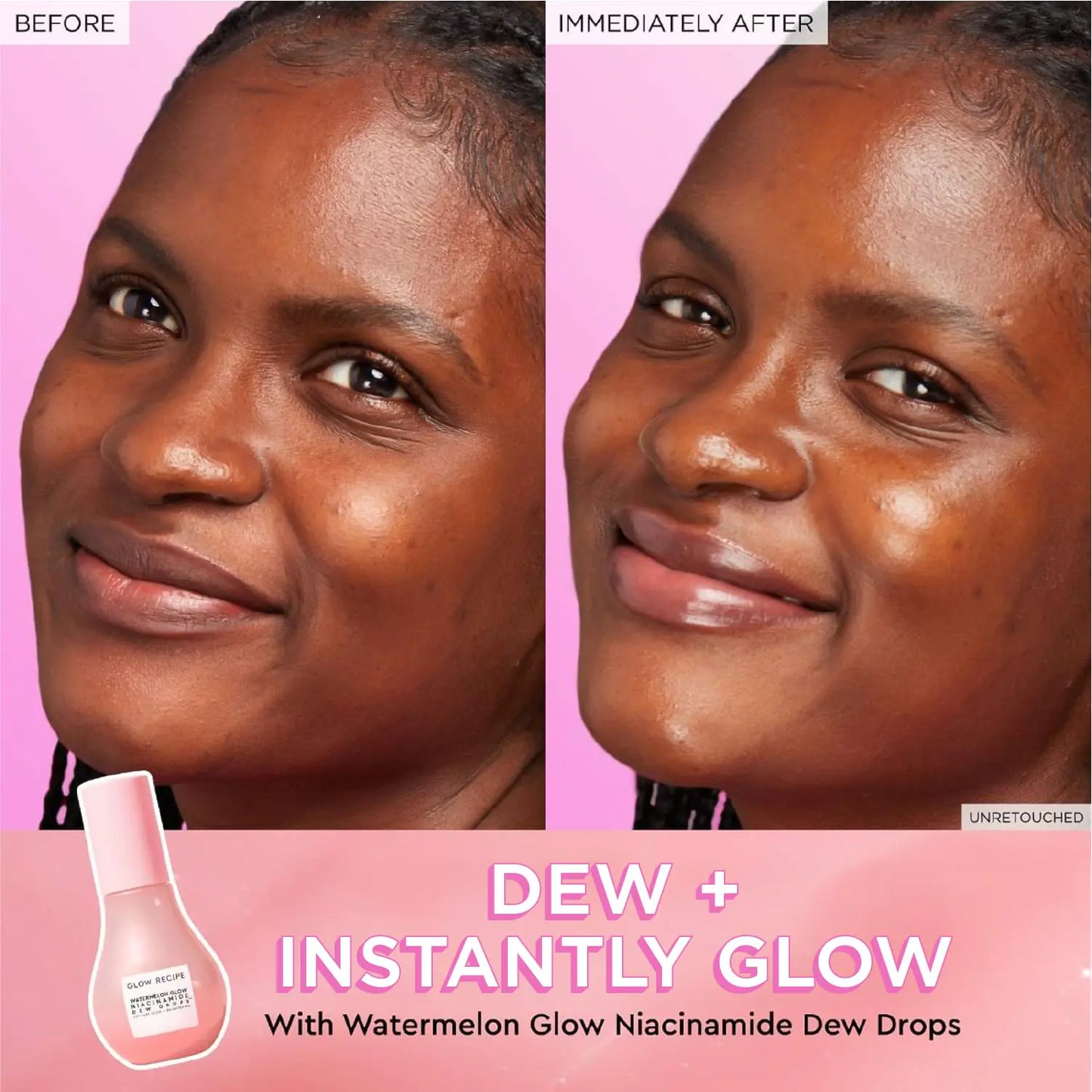 Before and Immediately After - Dew + Instant Glow with Watermelon Glow Niacinamide Dew Drops
