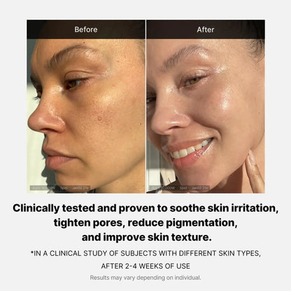 Before and after using Medicube Triple Collagen after 2-4weeks of use Clinically tested and proven to soothe skin Irritation, tighten pores, Reduced Pigmentation, and improve Skin texture