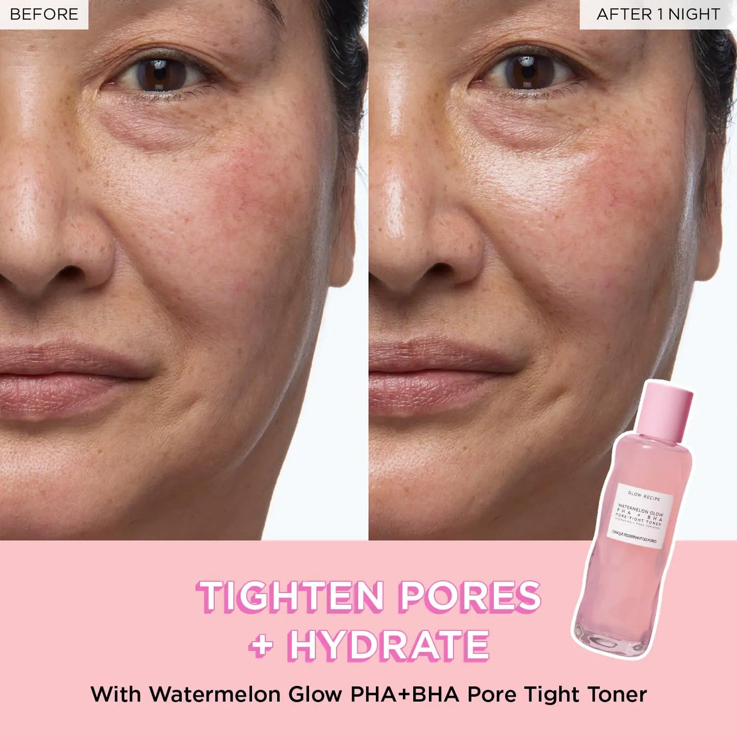 Tighten pores + hydrate 