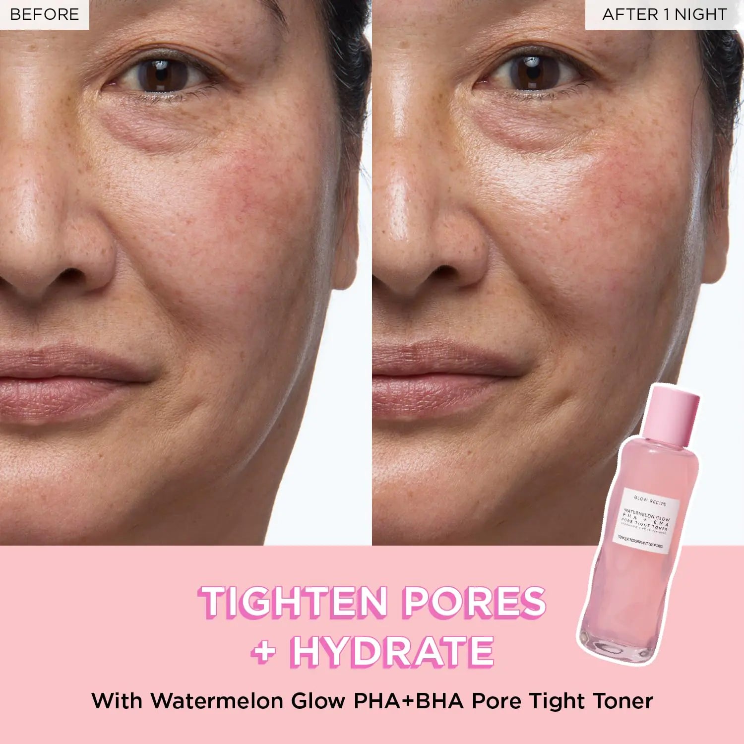 Tighten pores + hydrate 