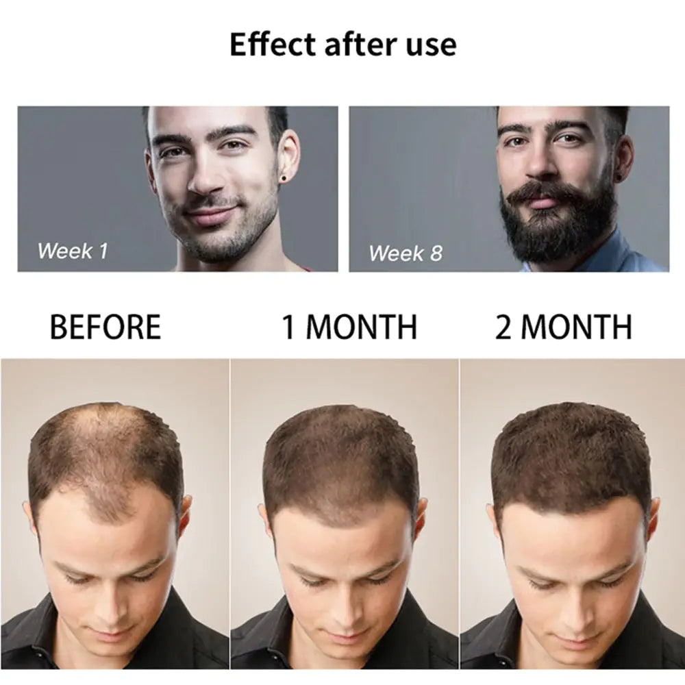 After using - week 1 to week 8 - Before and after 1 month and 2 months of using 
