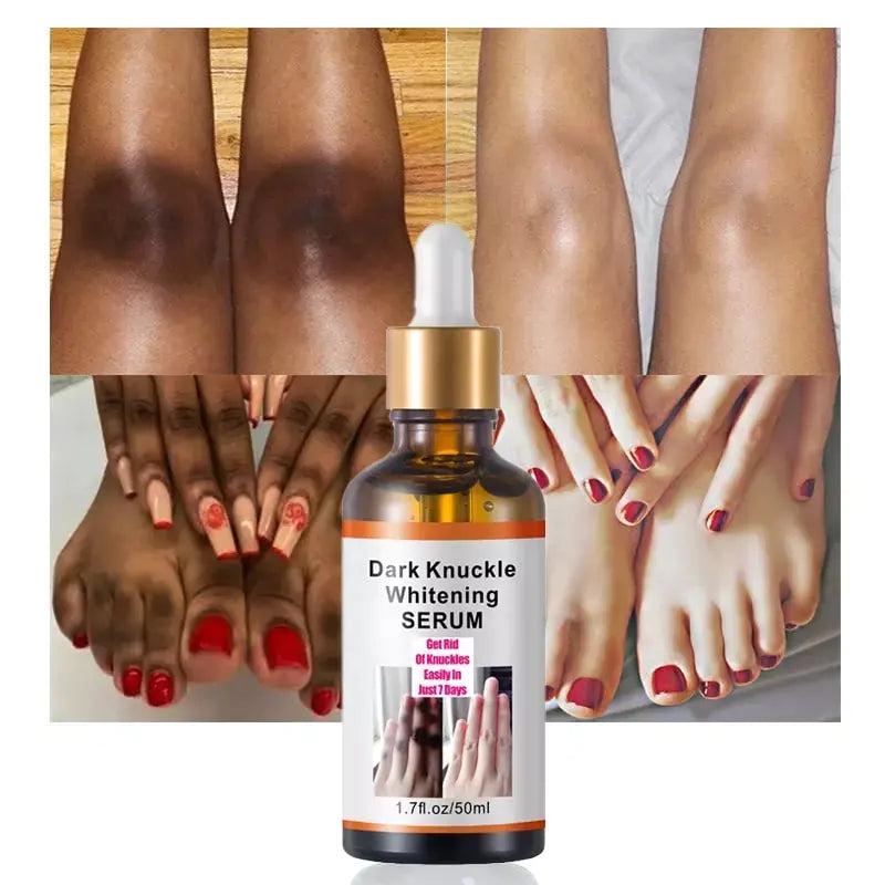 Results of Intense Knuckle Whitening Serum Results