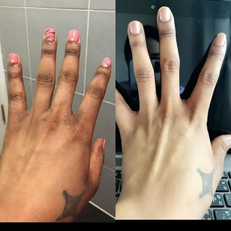Intense Knuckle Whitening Serum - DivineLuxes