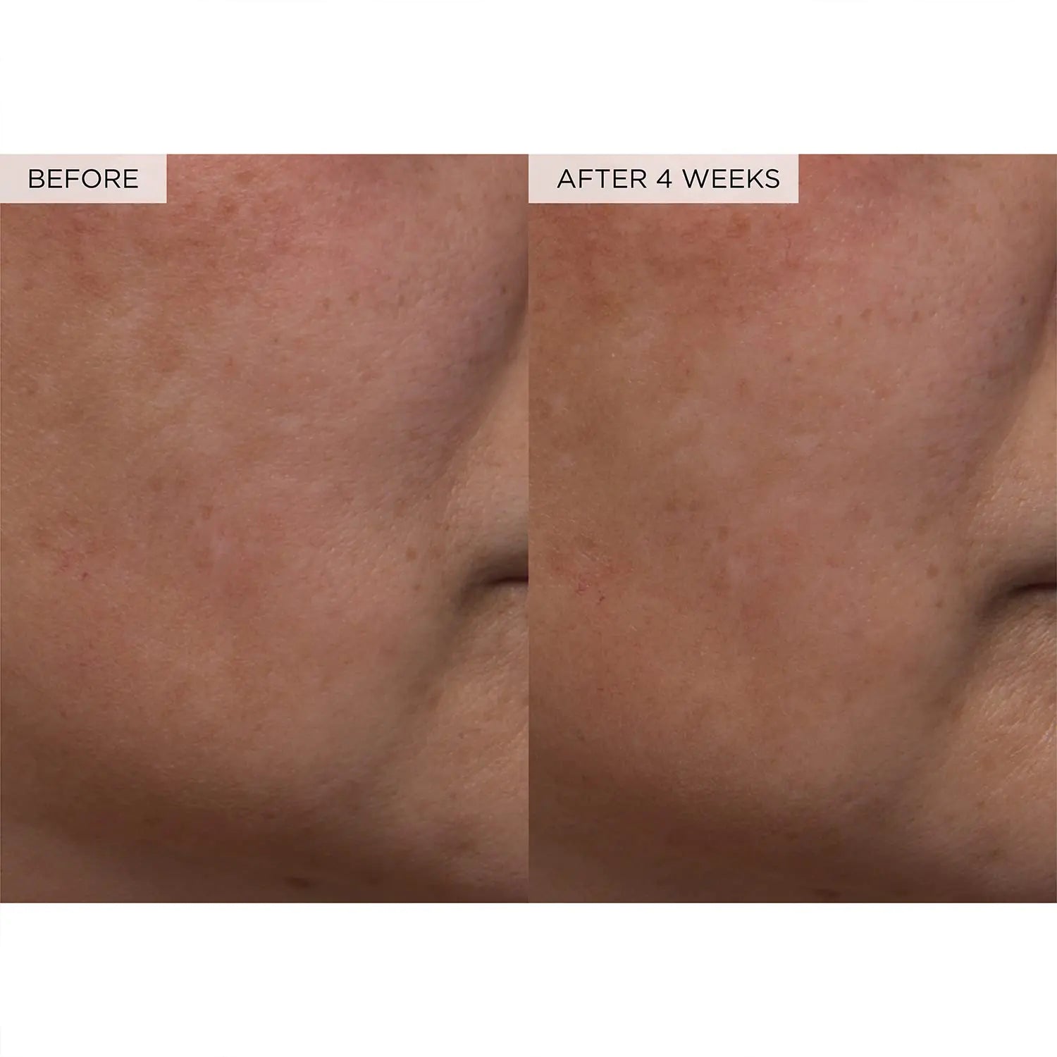 Before and After 4 weeks results