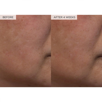 Before and After 4 weeks results