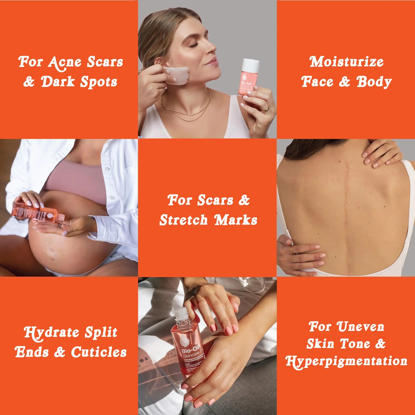 Where to apply the Bio-Oil Skincare Body Oil