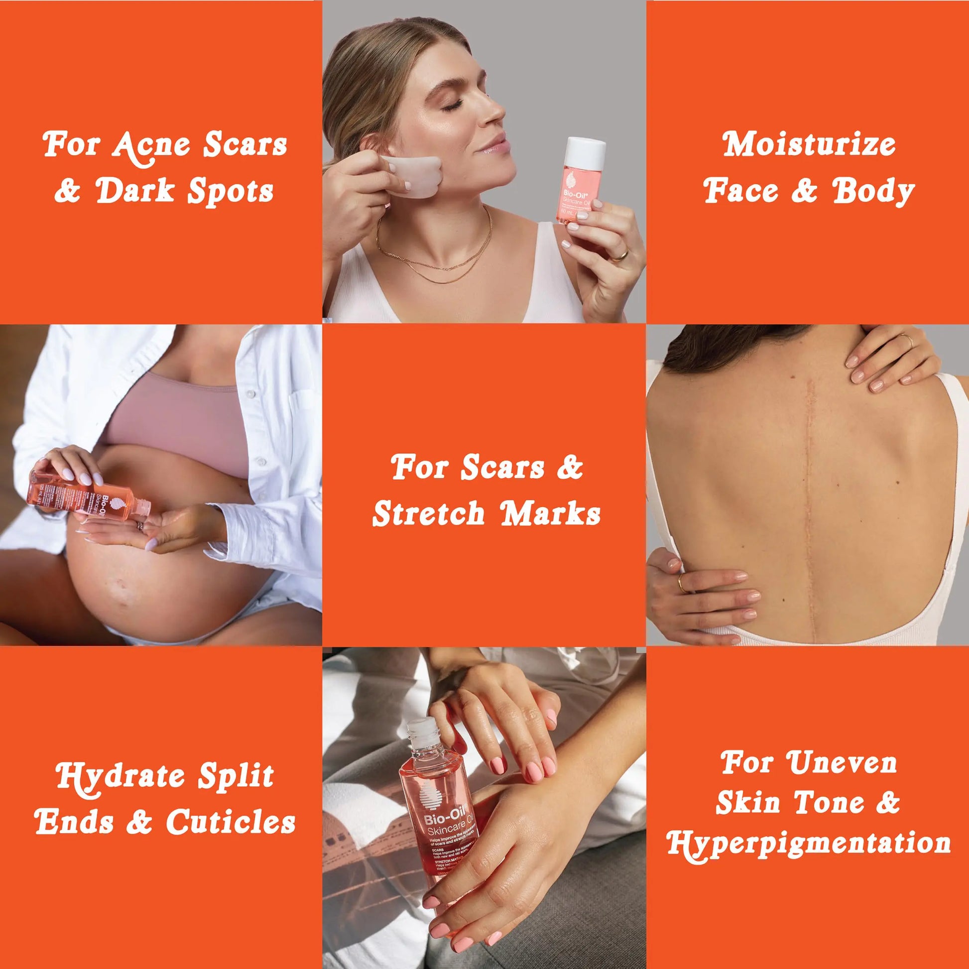 Where to apply the Bio-Oil Skincare Body Oil