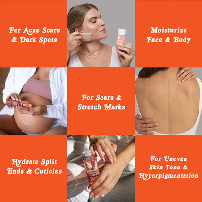 Where to apply the Bio-Oil Skincare Body Oil